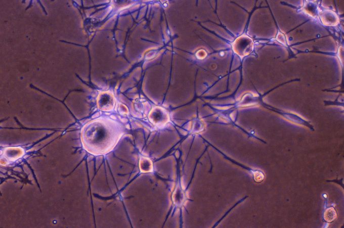 Eternal Life – Psych!